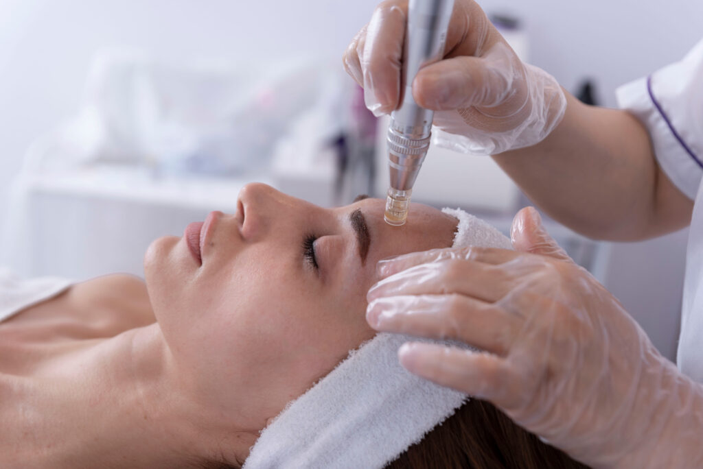 infinity esthetique salon institut de beauté paris 13 soin du visage micro needling microneedling